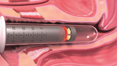 ステップ１・２の様子